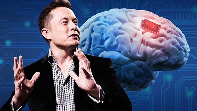 cong-nghe-chip-nao-neuralink-cua-elon-musk